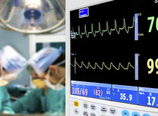 patient cardiogram monitoring in operation room